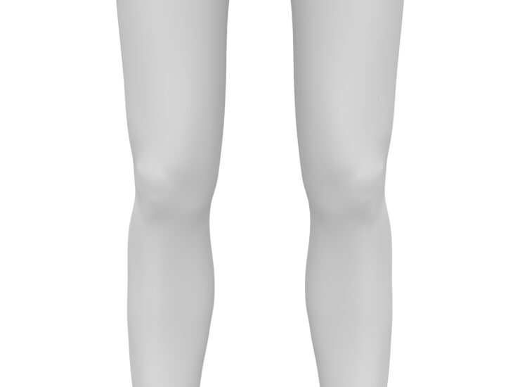 Lipödem Fettabsaugung Klagenfurt Kärnten